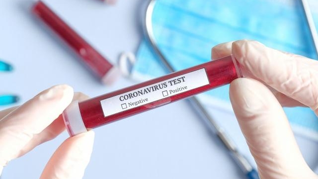 Două surori românce au murit de coronavirus