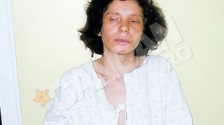 O femeie avea intre intestine un fat mort