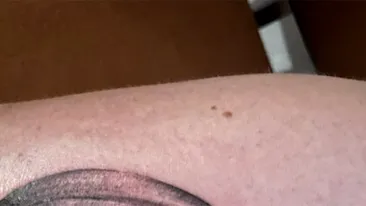 Acest tânăr a vrut să-și tatueze un ochi pe antebraț, dar rezultatul e de-a dreptul ilar