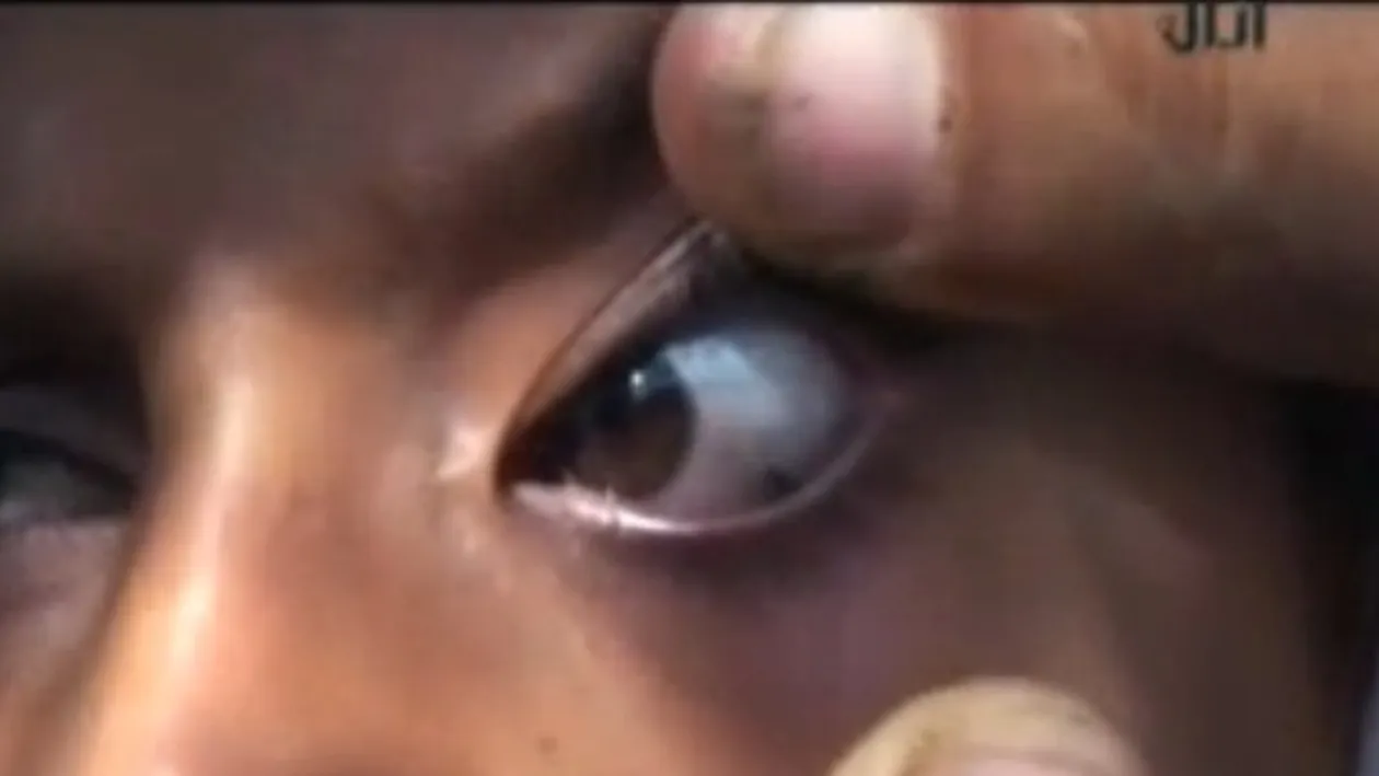 Caz cutremurator! Fetita care plange lacrimi de PIATRA! Oamenii sunt ingroziti: E posedata de diavol