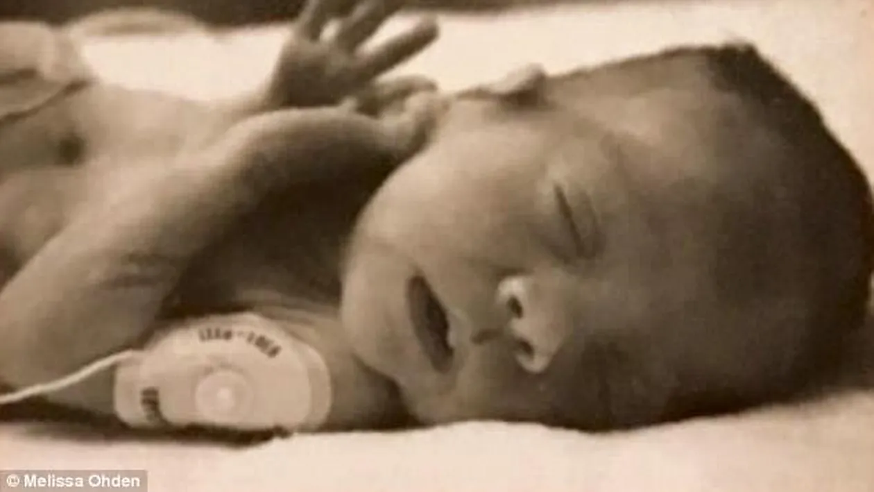 A fost avortată de mamă la 8 luni şi aruncată la gunoi, dar a supravieţuit! Cum arată acum femeia ajunsă la 40 de ani