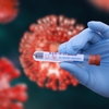 Alertă de coronavirus în Europa! Noua tulpină XFG, depistată în Marea Britanie