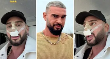 Dorian Popa, la un pas să îi „cadă nasul ca lui Michael Jackson”! Ce i-a descoperit medicul la operație? „Habar nu aveam”