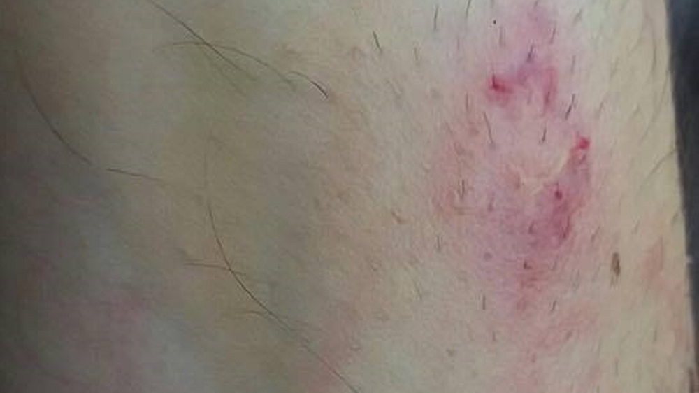 Un poliţist doljean aflat în misiune a fost muşcat de un fost deţinut