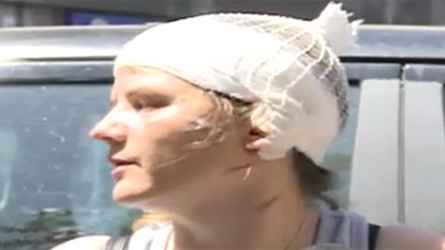 IMAGINI SOCANTE! Mama vitrega a lui Serban Huidu cu capul bandajat! Agresorul a incercat sa-i taie o ureche si aproape a mutilat-o