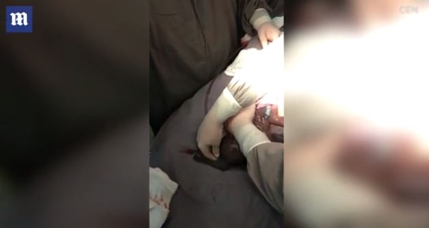 Imagini emoționante în sala de operații: un băiețel s-a născut în timp ce era încă în sacul amniotic. Cazul este foarte rar: 1 la 80.000 de nașteri | FOTO & VIDEO