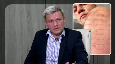 Super-modelul Andre Bîrleanu rupe tăcerea, după acuzațiile fostei partenere: „Am fost bătut”