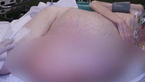 Ce ii crestea acestei femei in BURTA! Medicii au fost ingroziti cand au operat-o! "Cum se poate asa ceva?"