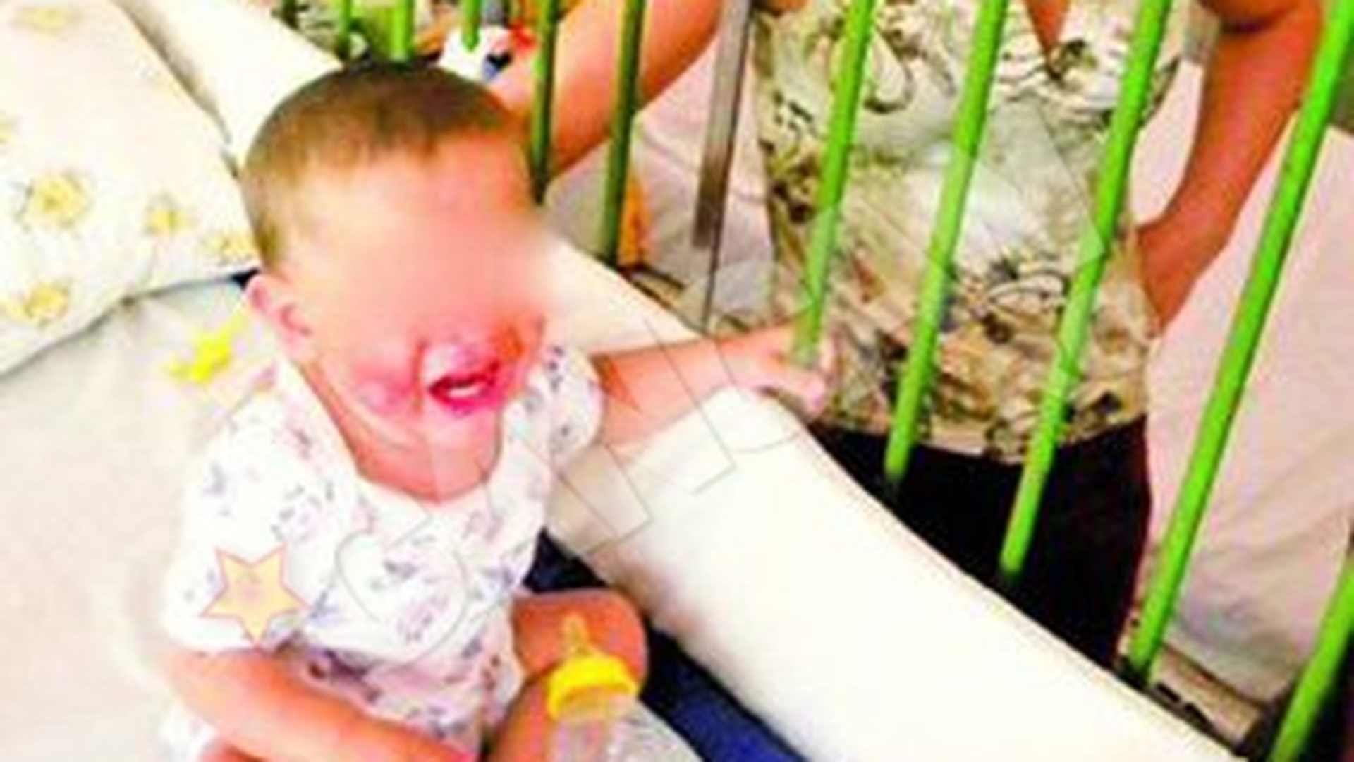 Copilul torturat de mama va fi dat in plasament! L-a ars cu un cutit incins pe fata