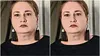 Ea este Cristina Buburuzanu, asistenta UPU care a murit într-un accident rutier cumplit. Soțul și fiul ei sunt în stare gravă la spital