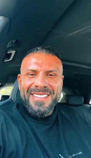 Narcis Bujor, acuzat de fani că și-a înjectat buzele! Ce intervenții estetice și-ar fi făcut ispita de la Insula Iubirii, de fapt