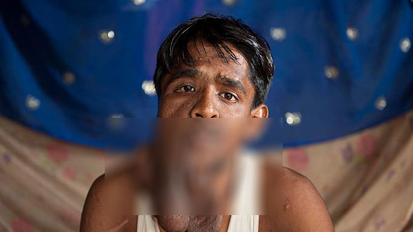 Ce se va intampla in scurt timp cu OMUL ELEFANT! Nimeni nu credea ca este posibil ASA CEVA!