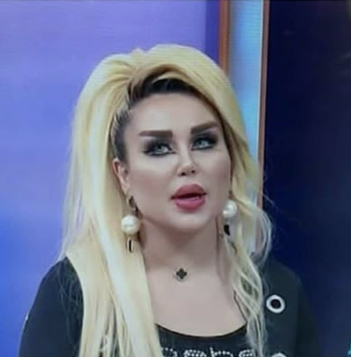 Dalia a vrut să arate ca păpușa Barbie, dar rezultatul i-a șocat pe apropiați. După 43 de operații, tânăra de 30 de ani este asemănată cu un zombi