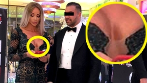 Bianca Drăgușanu, cu o vânătaie imensă pe bust. A fost lovită în sâni?!