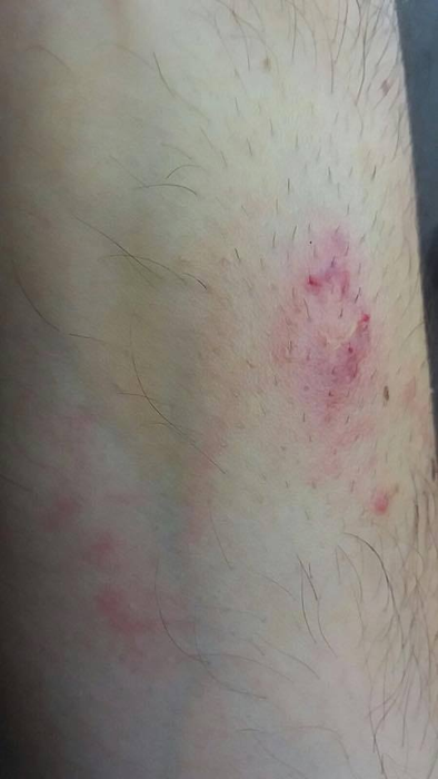 Polițistul a fost mușcat în misiune