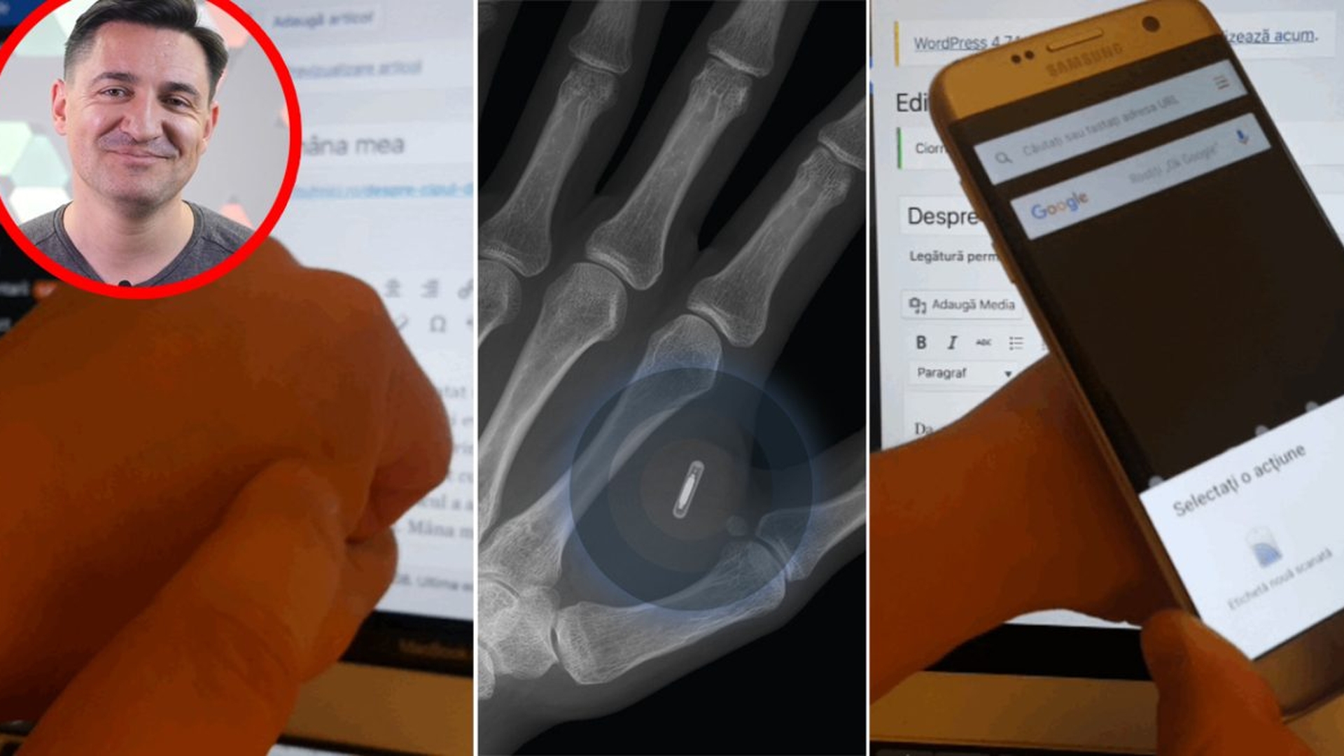 Motivul pentru care George Buhnici și-a implantat un microcip în mâna stângă: "Un doctor mi l-a injectat cu o seringă"
