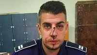 Poliţist cu nasul spart, după ce a primit un cap în faţă de la un şofer beat. S-a întâmplat în Dolj