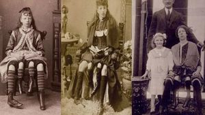 Cazul care a uimit o lume întreagă. Cine este Josephine Myrtle Corbin, femeia cu patru picioare