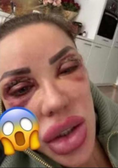 Alex Bodi a recunoscut! De ce a bătut-o, de fapt, pe fosta lui soţie, Bianca Drăguşanu: „Să dau eu într-o femeie trebuie să existe o sumedenie de provocări”