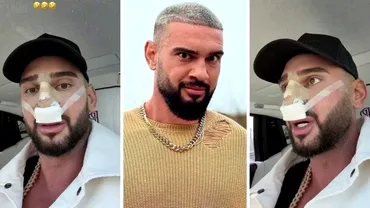 Dorian Popa, la un pas să îi „cadă nasul ca lui Michael Jackson”! Ce i-a descoperit medicul la operație? „Habar nu aveam”