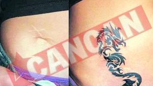 Vedetele isi mascheaza cicatricele cu tatuaje