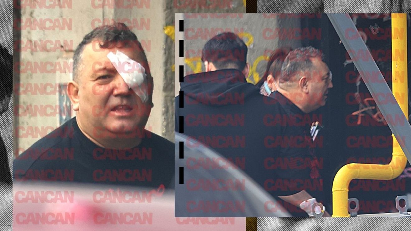 Primele & singurele imagini cu faimosul Beinur după ce a fost împușcat!