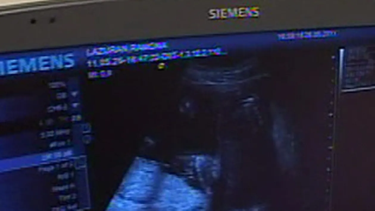 VIDEO Ramona Lazuran va naste o fetita!