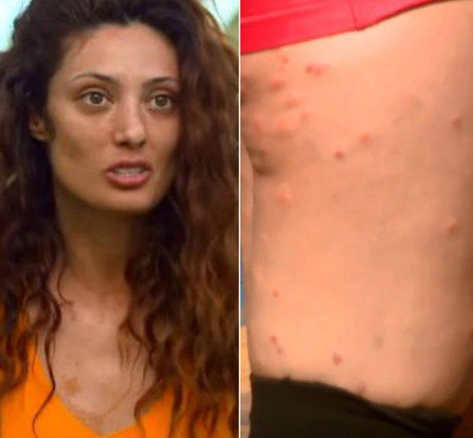 Cum arată picioarele lui Cream la trei lui de la ieșirea din Exatlon! Artista a rămas cu urme