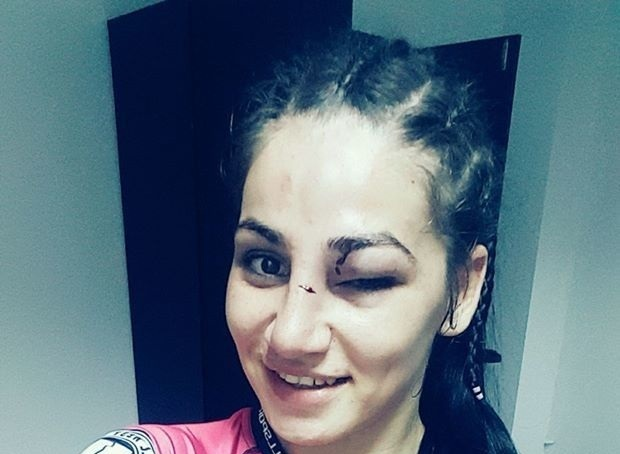 VIDEO / EXATLON. Ea e luptătoarea de MMA din echipa ”Faimoşilor”! Plină de vânătăi, ”Prinţesa Războinică” rupe tăcerea: ”Pentru voi …”