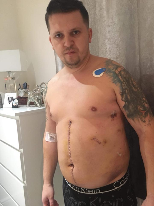 Scene de groază în Londra! Un român a fost înjunghiat în cap și lângă inimă de un grup imens de copii! A scăpat ca prin urechile acului. Atenție, imagini șocante!