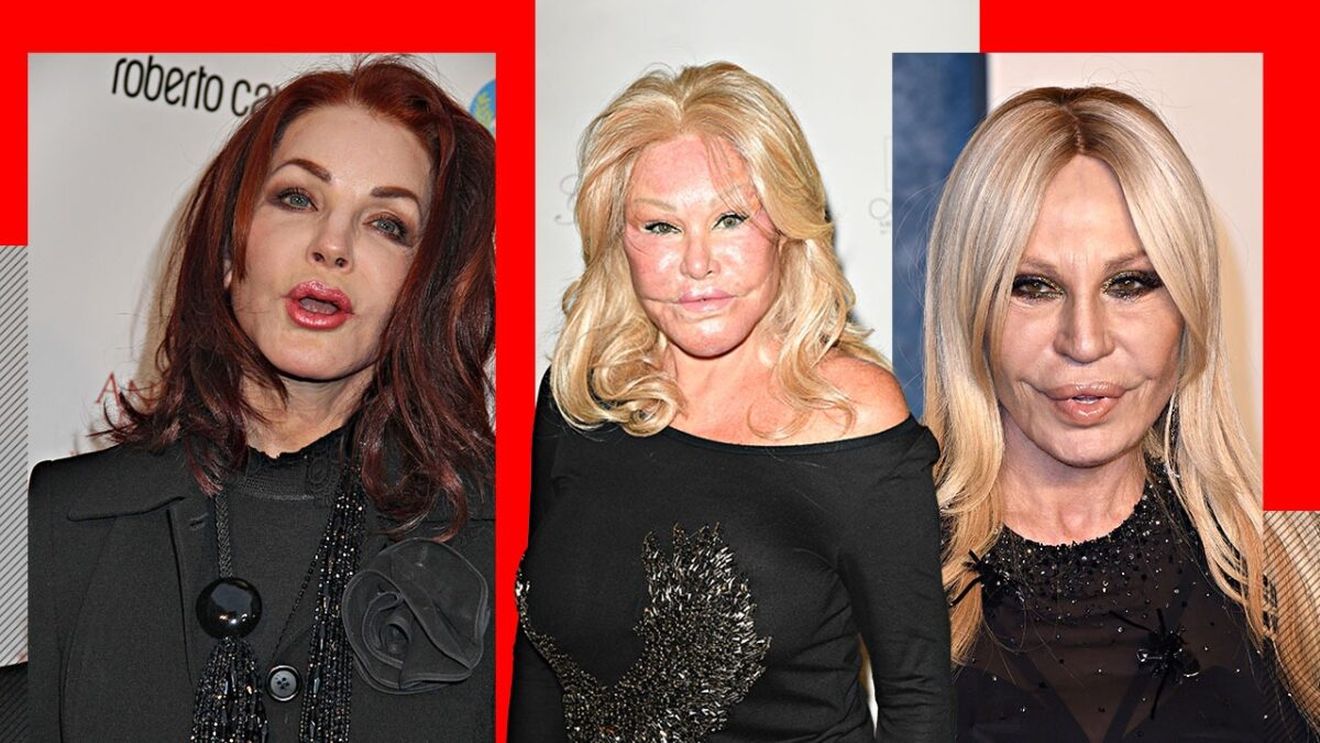TOP 5- Vedete de la Hollywood care s-au ales cu chipul desfigurat în urma operațiilor estetice. Jocelyn Wildenstein sau Donatella Versace arată de nerecunoscut!
