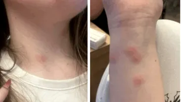 Caz revoltător în CFR! O tânără a ajuns direct la spital după ce a călătorit la cușetă. A plătit 190 de lei pe bilet