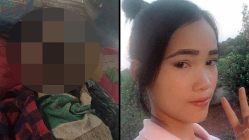 A mers la dentist pentru ca avea probleme cu dintii, dar a fost la un pas de moarte. Ce a patit tanara de 18 ani la chip 