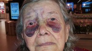 O bătrână a fost bătută cu bestialitate de fiică şi ginere! Imagini şocante şi povestea sfâşietoare a femeii care vrea să scape de acasă