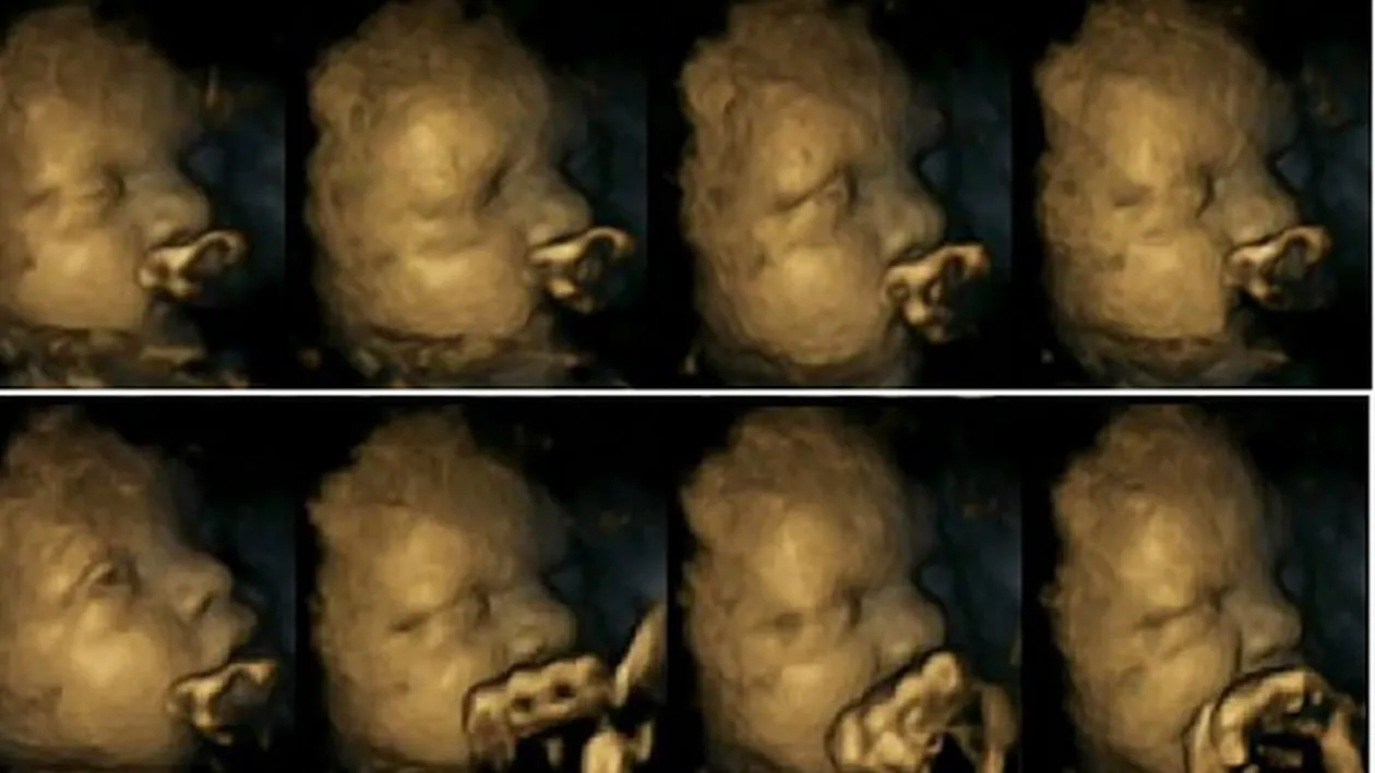 Fumezi in timpul sarcinii? Trebuie sa vezi asta! Cum reactioneaza fatul cand mama lui isi aprinde o tigara