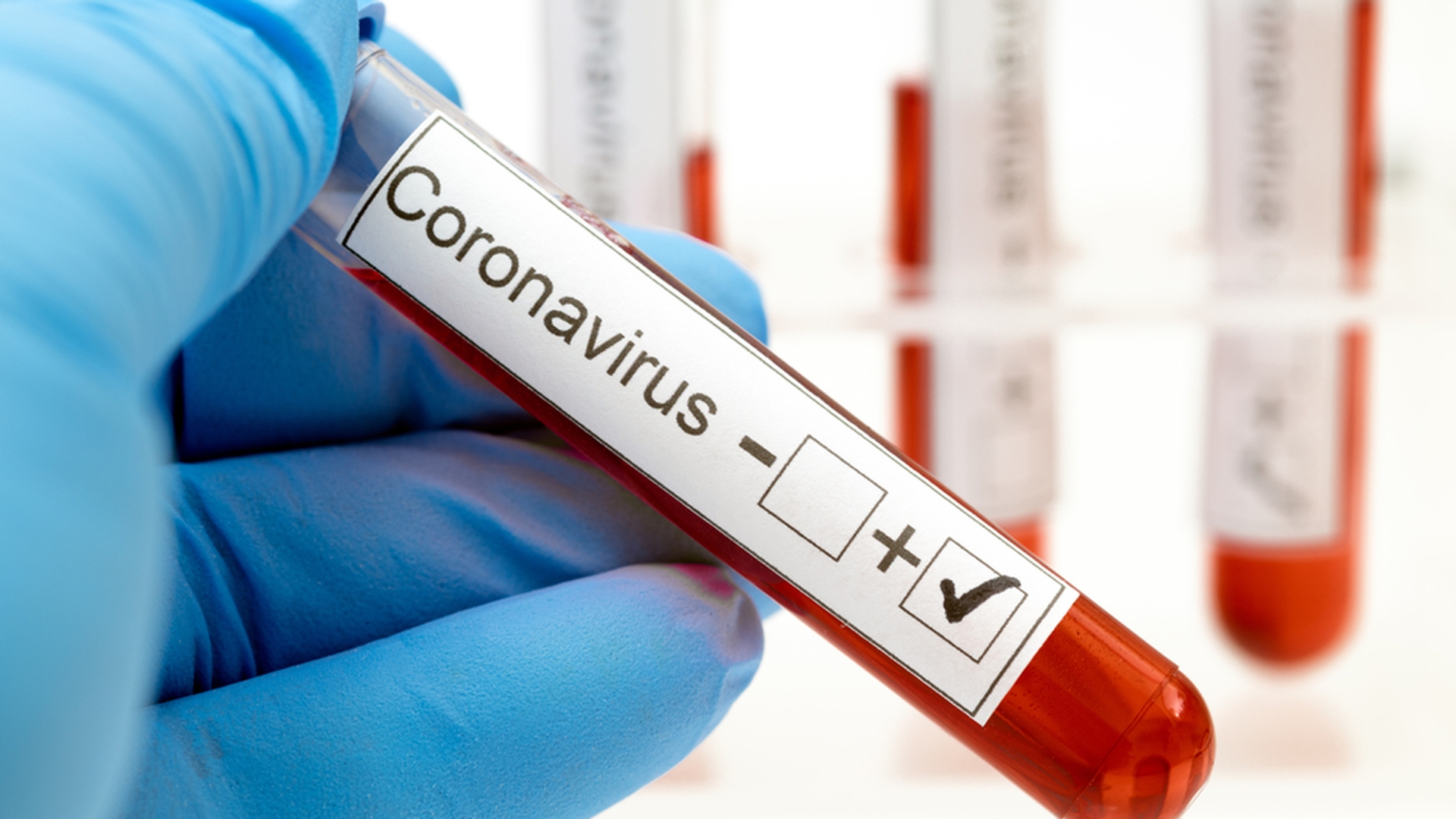Coronavirus România, 20 februarie. 57 de decese s-au înregistrat în ultimele 24 de ore