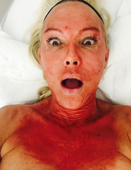 Natascha Ochsenknecht, tratament facial
