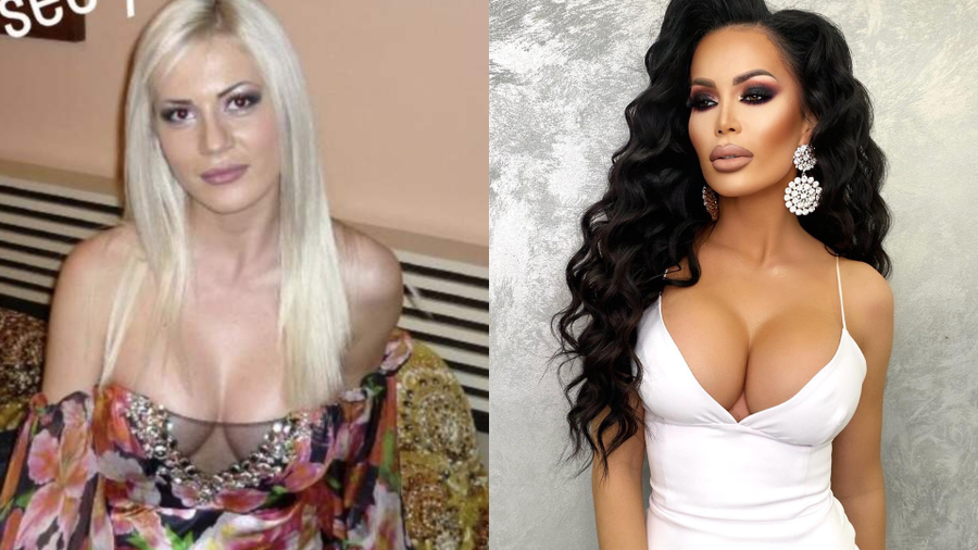 bianca pop operatii estetice