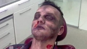 Mihai Trăistariu şochează din nou! Vezi fotografia care te înspăimântă:''M-am speriat, parcă eşti mort''