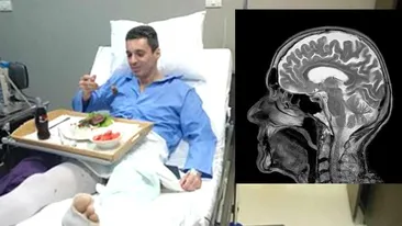 Mircea Badea, diagnostic șocant de la medici: Sunt în prag de atac cerebral din cauza loviturilor