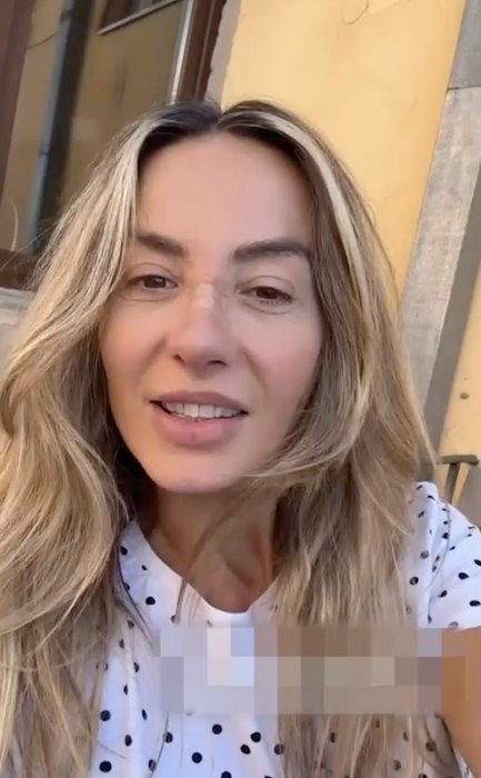 Cum arată Flavia Mihășan la 3 săptămâni de la operația la nas. Vedeta e schimbată total!