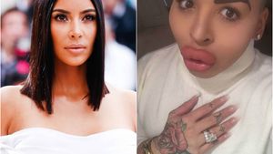 Acest tânăr de 23 de ani a cheltuit 150 de mii de dolari pentru a arăta precum KIM KARDASHIAN