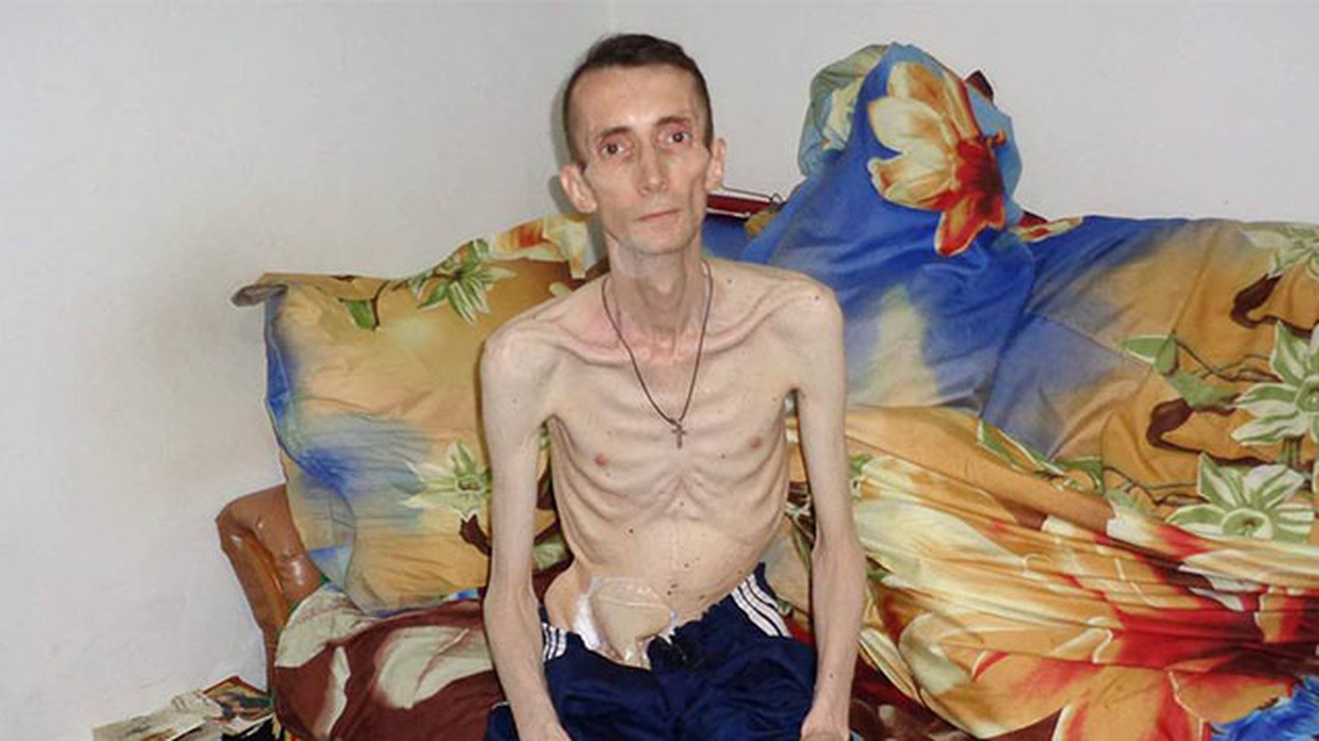 La 47 de ani, Eugen Movilă are doar 28 kg! “Nu am mai mâncat nimic de 3 ani”