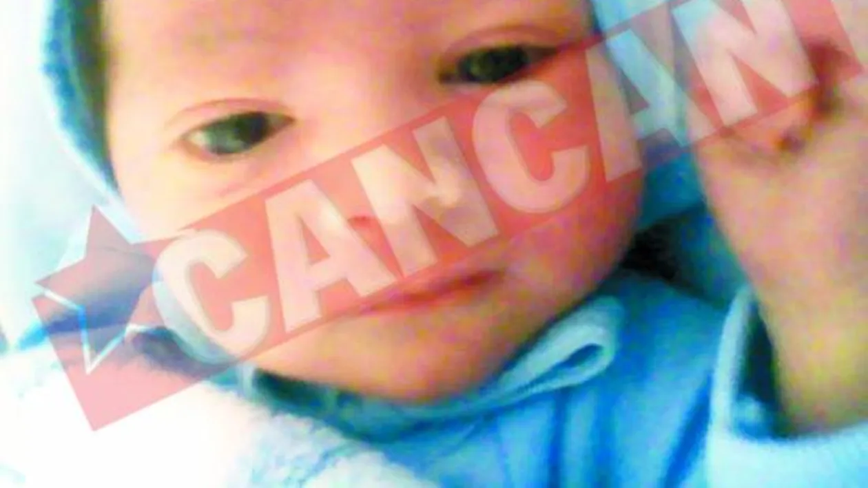 Bebelusul ars lupta pentru viata sa