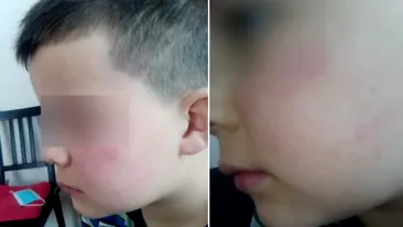 Un băiețel de 7 ani a fost bătut de tatăl unei colege. Micuțul refuză să mai meargă la școală
