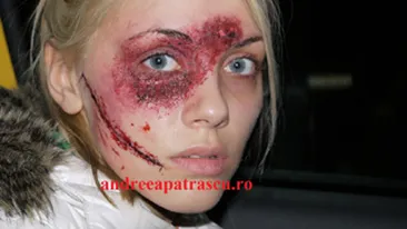 Andreea Patrascu, nevoita sa-si ascunda ranile de pe fata: Am pornit prin trafic cu gluga in cap si cu ochelari de soare