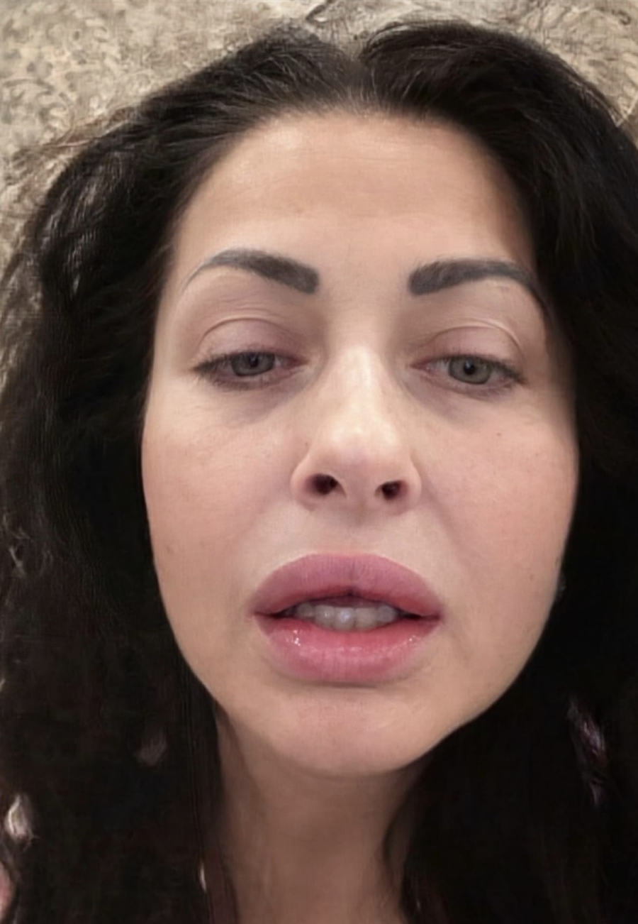 Gabriela Cristea a apărut cu fața umflată/ Sursa: Social media