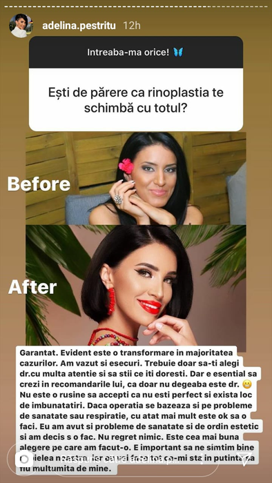 Adelina Pestrițu își dorește să prezinte o emisiune: “Am primit multe oferte să mă reîntorc”. A dezvăluit câte operații și-a făcut, de fapt, la nas