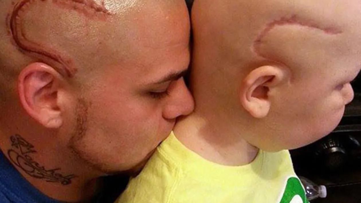 Un tată şi-a tatuat cicatricea fiului său de opt ani. Povestea care a emoţionat o lume întreagă