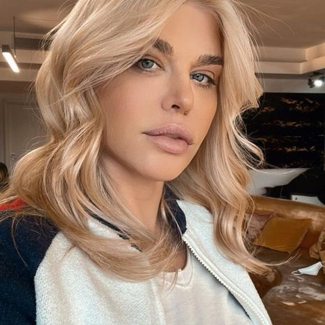 Loredana Groza, după ce fanii au acuzat-o că a apelat la operații estetice